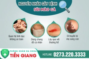 Xem Ngay Các Tác Nhân Gây Ra Sùi Mào Gà Và Cách Phòng Tránh