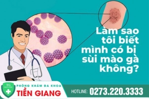 Nhận Biết Sớm Các Hiện Tượng Của Bệnh Sùi Mào Gà Và Cách Phòng Tránh