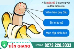 Đừng Chủ Quan Khi Thấy Dương Vật Nổi Đỏ - Dấu Hiệu Cảnh Báo Sức Khỏe Có Vấn Đề