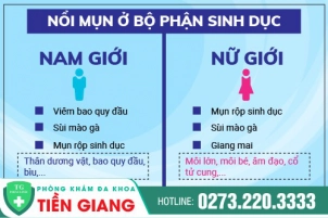 Nổi mụn ở bộ phận sinh dục là dấu hiệu của bệnh gì?