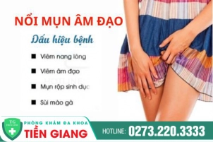 Nổi Mụn Ở Vùng Kín Nữ Là Dấu Hiệu Thông Báo Mắc Bệnh Gì? Phương Pháp Điều Trị Hiệu Quả