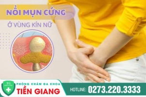 Nổi Mụn Cứng Ở Vùng Kín Nữ Giới Có Ảnh Hưởng Gì Không?