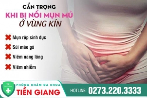 Nổi Mụn Mủ Ở Vùng Kín - Dấu Hiệu Cảnh Báo Có Thể Mắc Bệnh Xã Hội