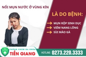 Mọc mụn nước ở vùng kín là do bệnh gì gây ra?