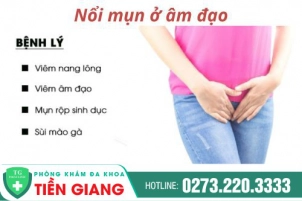 Âm đạo nổi mụn thịt - Nguyên nhân và cách điều trị như thế nào?
