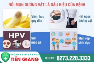 Cậu Nhỏ Bị Nổi Mụn Phải Làm Sao? Hỏi Đáp Cùng Bác Sĩ Chuyên Khoa