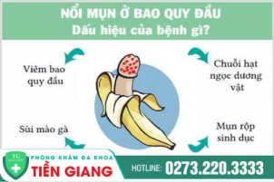 Quy Đầu Nổi Mụn Là Do Đâu? Nguy Hiểm Ra Sao Nếu Không Điều Trị Kịp Thời
