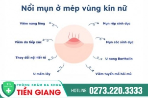 Thủ Phạm Khiến Âm Đạo Nổi Mụn Nước Là Gì? Hướng Điều Trị An Toàn?