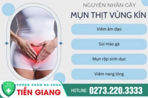 Mụn Thịt Bất Thường Ở Vùng Kín - Chị Em Chớ Chủ Quan