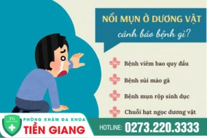 Dương Vật Nổi Mụn Trắng Là Dấu Hiệu Mắc Bệnh Gì?