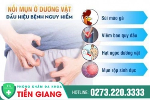 Cách Trị Mụn Dương Vật Hiệu Quả Và An Toàn Mà Nam Giới Không Nên Bỏ Qua