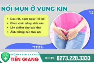 Trị mụn li ti ở vùng kín Tiền Giang - Nổi mụn li ti ở vùng kín là bệnh gì?