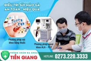 Bị Sùi Mào Gà Nên Khám Ở Đâu? Những Phương Pháp Điều Trị Hiệu Quả