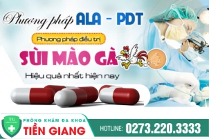 Chữa Sùi Mào Gà Hậu Môn Bằng Phương Pháp Nào An Toàn Và Hiệu Quả?