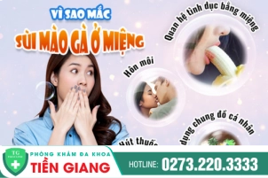 Nhận biết sùi mào gà ở miệng qua 6 dấu hiệu điển hình