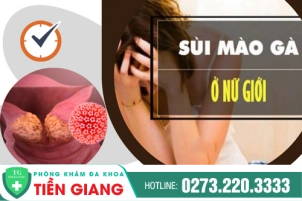 Sùi mào gà ở nữ: Dấu hiệu nhận biết, chi phí và cách điều trị hiệu quả