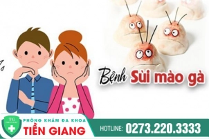 Sùi Mào Gà Ở Vùng Kín - Làm Cách Nào Để Khắc Phục