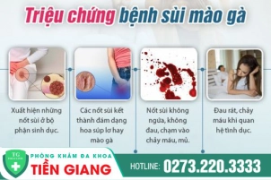 Thế Nào Là Bệnh Sùi Mào Gà? Dấu Hiệu, Nguyên Nhân Và Cách Phòng Tránh