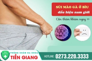 Nhận Biết Sớm Và Điều Trị Bệnh Sùi Mào Gà Ở Nam Giới