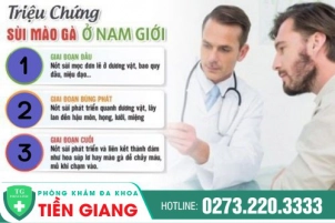 Cùng Chuyên Gia Nhận Biết Hiện Tượng Sùi Mào Gà Ở Nam Giới