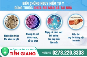 Thuốc Hỗ Trợ Điều Trị Sùi Mào Gà Nhanh Chóng, Hiệu Quả Và An Toàn