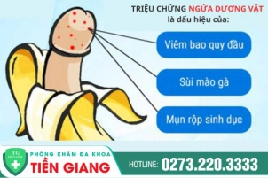 Những điều cần biết về ngứa dương vật