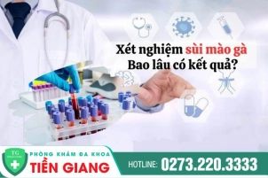 Xét Nghiệm Sùi Mào Gà Bao Lâu Có Kết Quả? Xét Nghiệm Ở Đâu Nhanh Chóng?