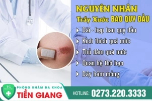 thumbbnail