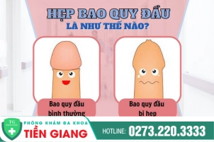 thumbbnail