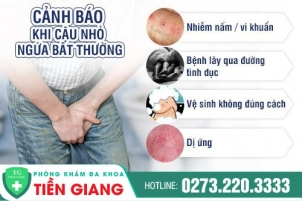 thumbbnail