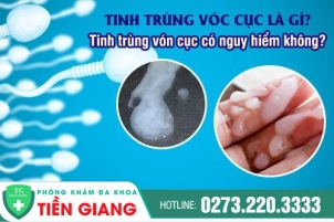thumbbnail