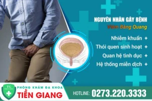 thumbbnail