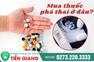 thumbbnail