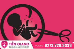 thumbbnail