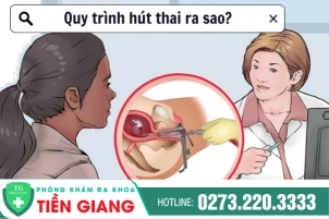 thumbbnail