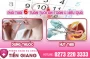 Cách hút thai 6 tuần tuổi hiệu quả