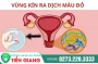 Dịch tiết âm đạo có màu đỏ có sao không?