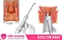 Đốt Viêm Lộ Tuyến Có Ảnh Hưởng Gì Không? Điều Chị Em Nên Biết