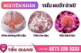 Những Phương Pháp Điều Trị Tiểu Buốt Ở Phụ Nữ
