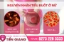 Tiểu buốt ở phụ nữ: Nguyên nhân, dấu hiệu và cách điều trị hiệu quả